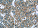 S100A6 Antibody in Immunohistochemistry (Paraffin) (IHC (P))