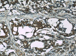 S100A6 Antibody in Immunohistochemistry (Paraffin) (IHC (P))