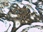 S100A6 Antibody in Immunohistochemistry (Paraffin) (IHC (P))