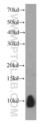 S100A6 Antibody in Western Blot (WB)