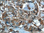 P4HA1 Antibody in Immunohistochemistry (Paraffin) (IHC (P))