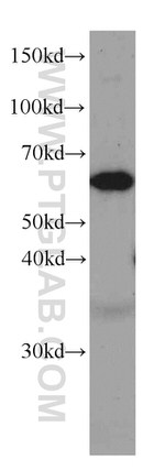 P4HA1 Antibody in Western Blot (WB)