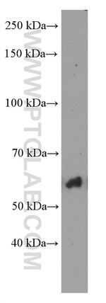 P4HA1 Antibody in Western Blot (WB)