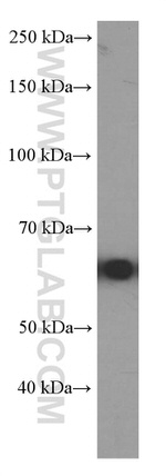 P4HA1 Antibody in Western Blot (WB)