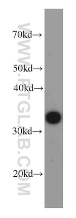 MBIP Antibody in Western Blot (WB)