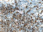 CD22 Antibody in Immunohistochemistry (Paraffin) (IHC (P))