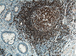 CD22 Antibody in Immunohistochemistry (Paraffin) (IHC (P))