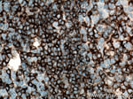 CD22 Antibody in Immunohistochemistry (Paraffin) (IHC (P))