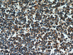 CD22 Antibody in Immunohistochemistry (Paraffin) (IHC (P))