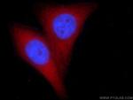 PGM1 Antibody in Immunocytochemistry (ICC/IF)