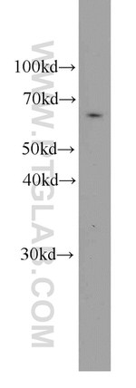 PGM1 Antibody in Western Blot (WB)