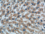 Prealbumin/transthyretin Antibody in Immunohistochemistry (Paraffin) (IHC (P))