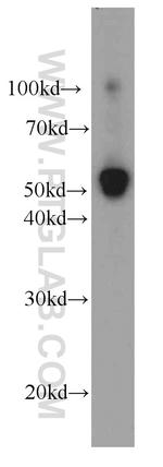 Iduronate 2 sulfatase Antibody in Western Blot (WB)
