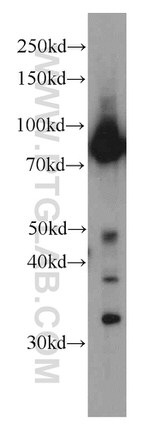 Iduronate 2 sulfatase Antibody in Western Blot (WB)