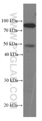Iduronate 2 sulfatase Antibody in Western Blot (WB)