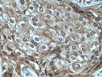 TFIP11 Antibody in Immunohistochemistry (Paraffin) (IHC (P))