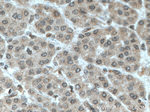 TFIP11 Antibody in Immunohistochemistry (Paraffin) (IHC (P))