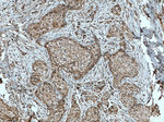 TFIP11 Antibody in Immunohistochemistry (Paraffin) (IHC (P))