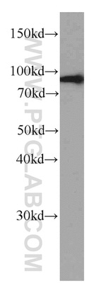 TFIP11 Antibody in Western Blot (WB)