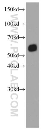 SMARCD1 Antibody in Western Blot (WB)