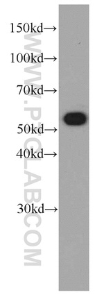 SMARCD1 Antibody in Western Blot (WB)