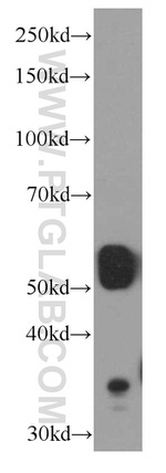 SMARCD1 Antibody in Western Blot (WB)