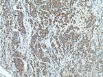 ECHS1 Antibody in Immunohistochemistry (Paraffin) (IHC (P))