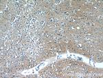 OXA1L Antibody in Immunohistochemistry (Paraffin) (IHC (P))