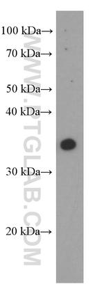 ARG1 Antibody in Western Blot (WB)