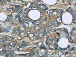 TRPC4AP Antibody in Immunohistochemistry (Paraffin) (IHC (P))