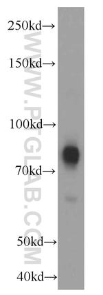 TRPC4AP Antibody in Western Blot (WB)