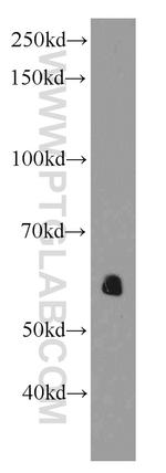 AEBP2 Antibody in Western Blot (WB)