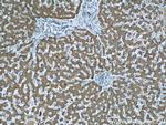 TIMM44 Antibody in Immunohistochemistry (Paraffin) (IHC (P))
