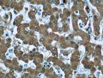TIMM44 Antibody in Immunohistochemistry (Paraffin) (IHC (P))
