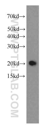 STMN3 Antibody in Western Blot (WB)
