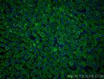 Complement factor B Antibody in Immunohistochemistry (PFA fixed) (IHC (PFA))