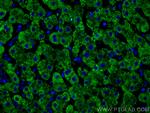 Complement factor B Antibody in Immunohistochemistry (PFA fixed) (IHC (PFA))
