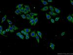 NUMBL Antibody in Immunocytochemistry (ICC/IF)