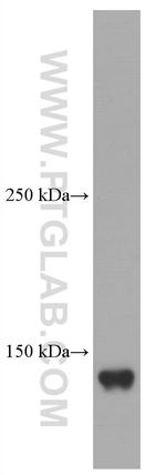 Ceruloplasmin Antibody in Western Blot (WB)