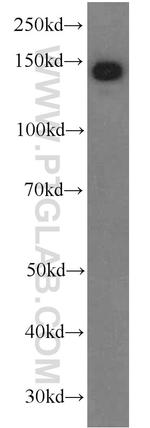 Ceruloplasmin Antibody in Western Blot (WB)
