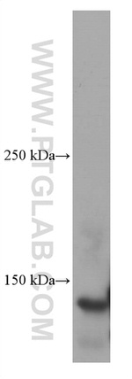 Ceruloplasmin Antibody in Western Blot (WB)