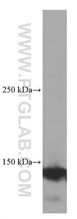 Ceruloplasmin Antibody in Western Blot (WB)