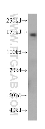 Ceruloplasmin Antibody in Western Blot (WB)