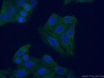 C3/C3b/C3c Antibody in Immunocytochemistry (ICC/IF)