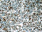 BMI1 Antibody in Immunohistochemistry (Paraffin) (IHC (P))