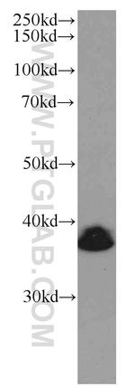 BMI1 Antibody in Western Blot (WB)