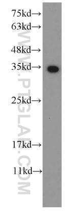 S1 tag Antibody in Western Blot (WB)