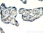 HBG1 Antibody in Immunohistochemistry (Paraffin) (IHC (P))