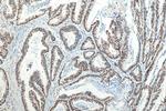 MSH6 Antibody in Immunohistochemistry (Paraffin) (IHC (P))