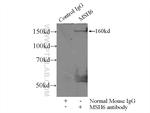 MSH6 Antibody in Immunoprecipitation (IP)